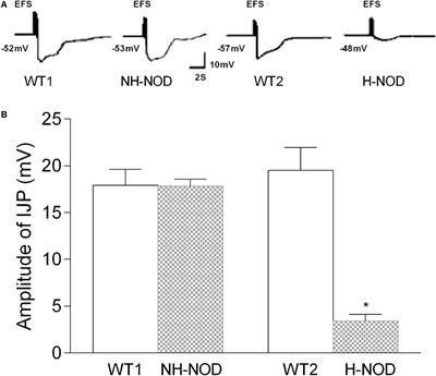 Effect of Hyperglycemia on Purinergic and Nitrergic Inhibitory Neuromuscular Transmission in the Antrum of the Stomach: Implications for Fast Gastric Emptying